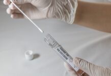 Prefeitura disponibiliza testes para assintomáticos