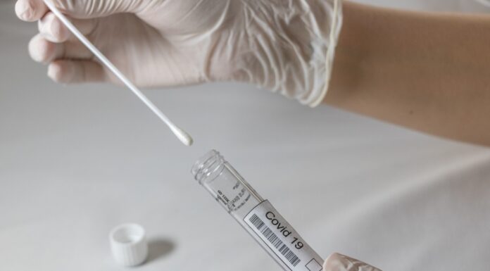 Prefeitura disponibiliza testes para assintomáticos