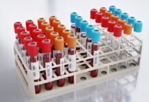 Varíola dos macacos: casos suspeitos são investigados em Belo Horizonte, Ouro Preto e Ituiutaba😂