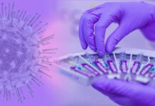 Casos de Covid-19 segue em alta no Brasil; Número de contaminações subiu para 262% em duas semanas